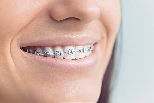 Best Wisdom Tooth Removal  in Edmond, OK